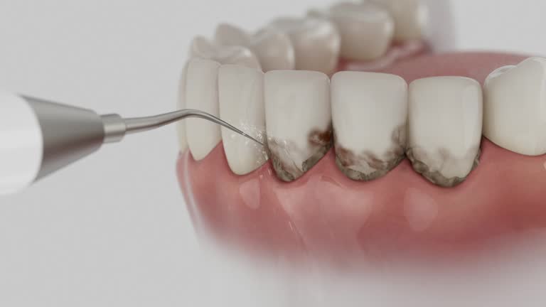 Reliable Emergency Dentist contractor in Springboro, OH by Smile Center Dentistry